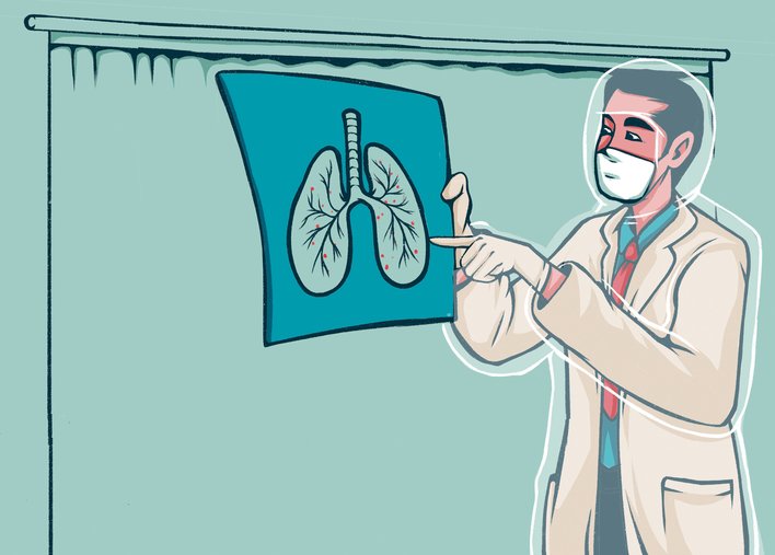 doctor examining an xray file
